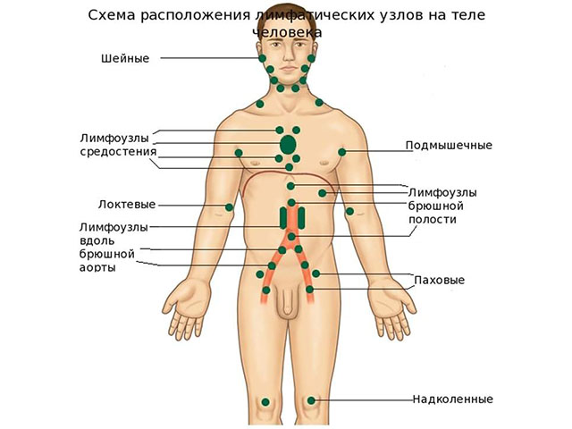 Паховый лимфаденит у мужчин - воспаление лимфоузлов в паху