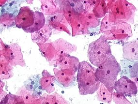 Gardnerella vaginalis