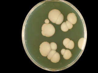 Candida albicans &mdash; причина развития молочницы
