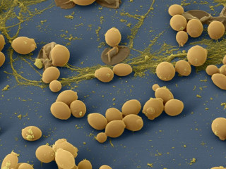 Грибок рода Candida &mdash; возбудитель вагинального кандидоза