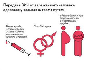 Признаки ВИЧ у женщин на ранних стадиях
